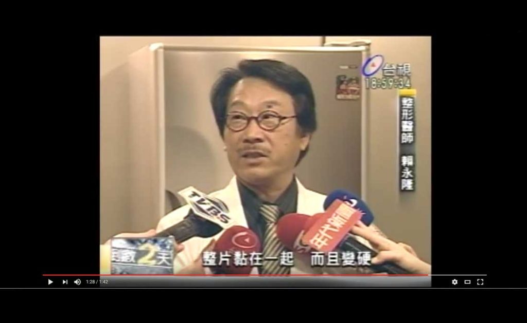 賴永隆院長談注射式隆乳風險|台視新聞