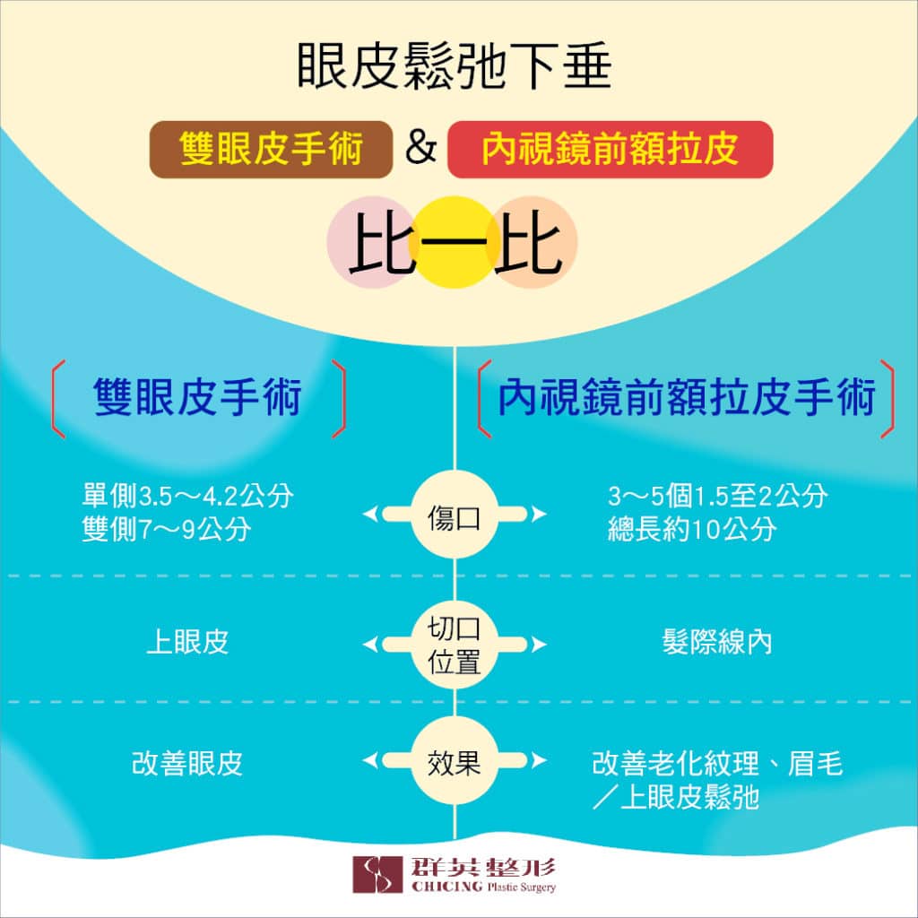 張世幸醫師｜內視鏡運用　前額拉皮還能算是「大」手術嗎？