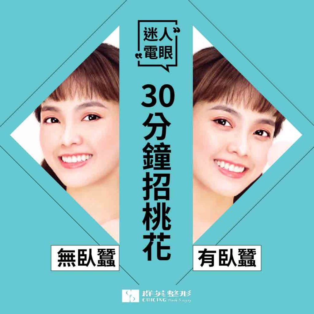 侯憲棋醫師|30分鐘招桃花　玻尿酸打造好人緣臥蠶