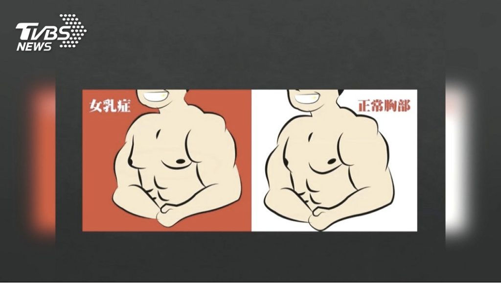 男性整形風潮　最愛整出六塊肌｜TVBS採訪