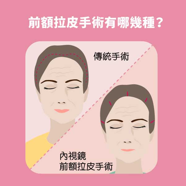 【分齡抗老】50s緊緻就少年｜蕭弘道醫師