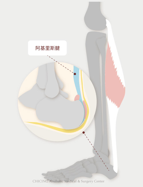 不動刀｜膝蓋退化、肩關節退化、運動傷害