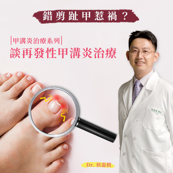 【甲溝炎治療系列】「錯剪趾甲」惹禍?!談再發性甲溝炎治療｜侯憲棋醫師