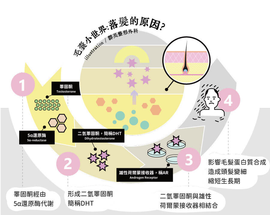 王冠穎醫師_雄性禿_植髮