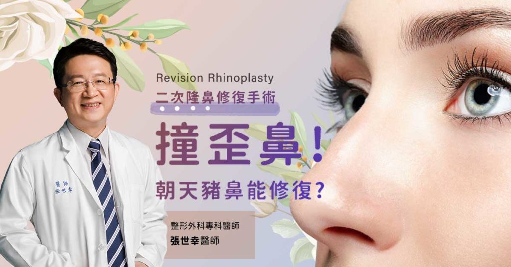 隆鼻後撞歪鼻,朝天「豬鼻」能修復?|張世幸醫師