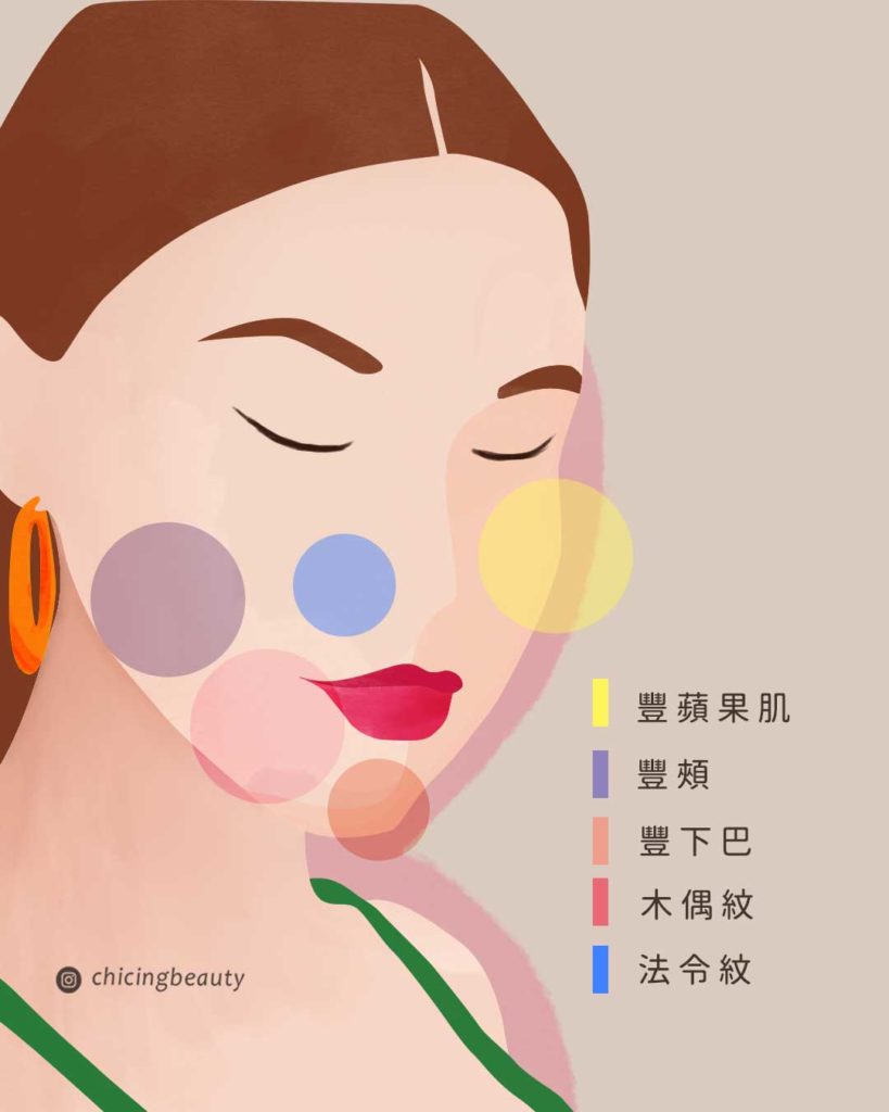 自體脂肪臉部補脂_陳建璋醫師