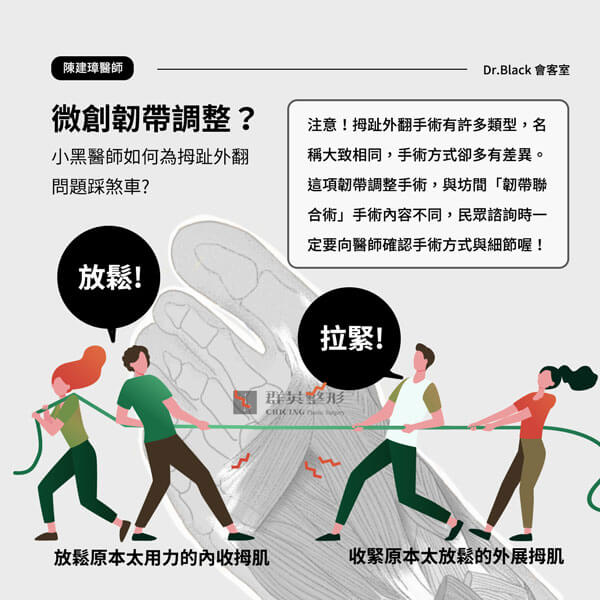 拇指外翻手術治療