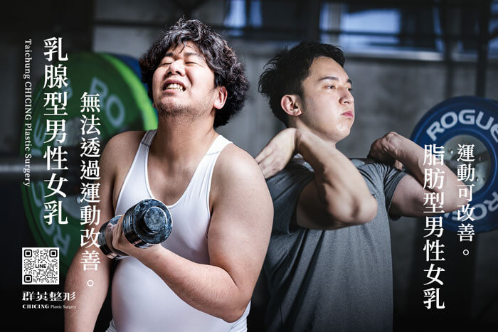真正男性女乳症需要透過手術改善＿女乳症台中推薦找林雍球醫師