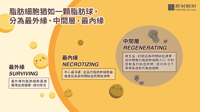 讓臉自然澎潤的秘密武器－自體脂肪移植手術｜整形外科陳廣得醫師