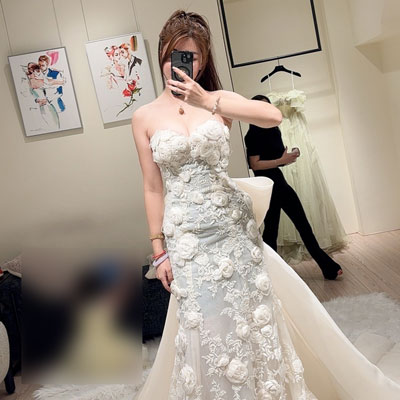 台中群英診所肋雕芭比腰手術案例，成功讓她穿上夢想婚紗